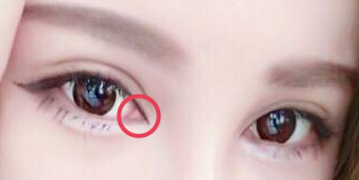 l Lasersurgery Hatyai Skin laser and beauty Lasersurgery